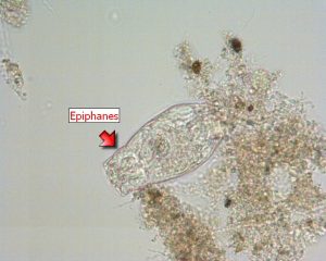 Rotifer – Epiphanes